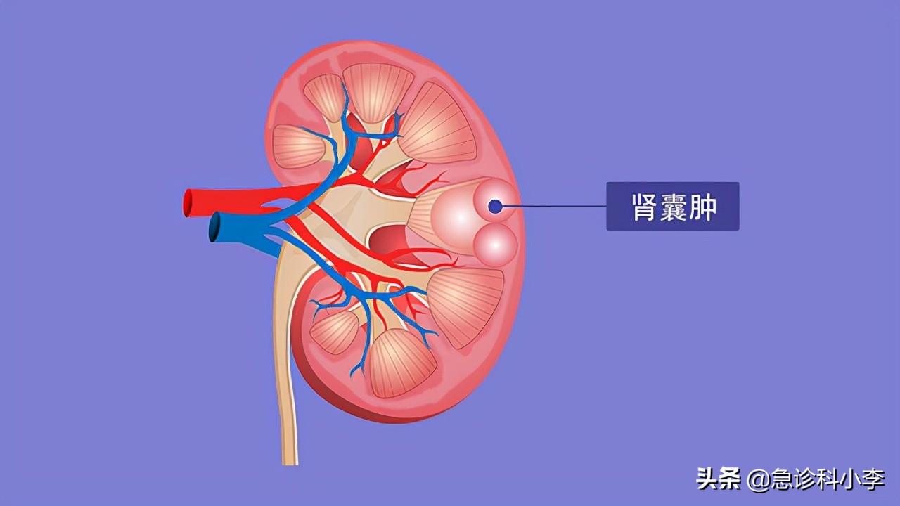 多发性脂囊瘤最新治疗方法的研究与应用进展