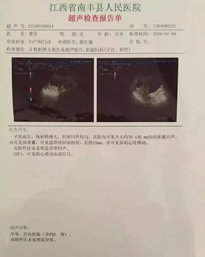 通草的功效与作用能通输卵管堵塞,迅捷解答方案实施_开发版13.29